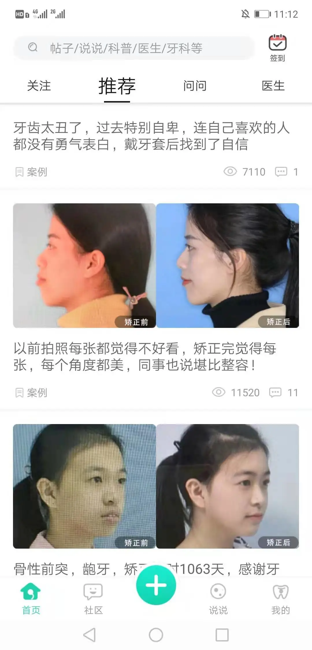 牙套之家手机客户端截图2
