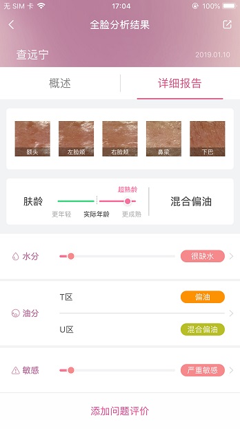 肌肤分析仪最新版截图0