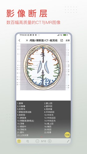 3dbody解剖免费版截图3