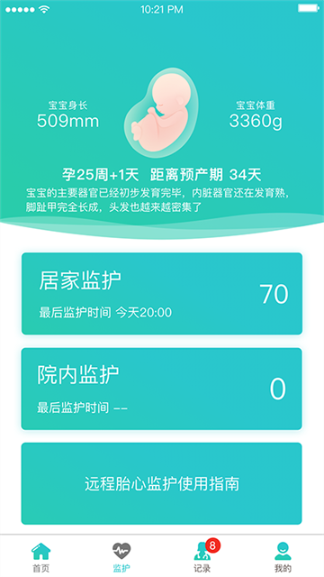 胎心监护截图0