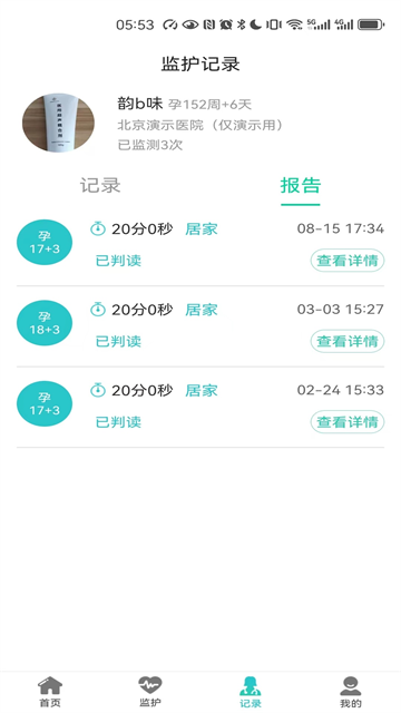胎心监护截图2