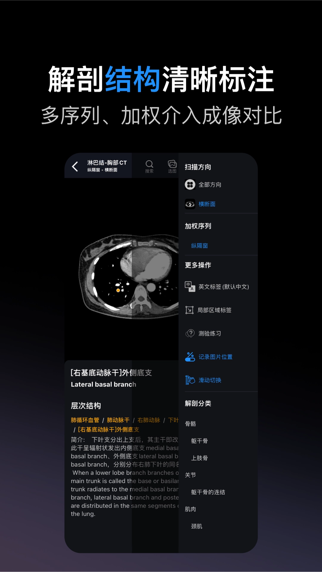 影像解剖图谱截图2