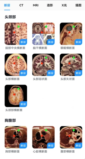 影像解剖图谱